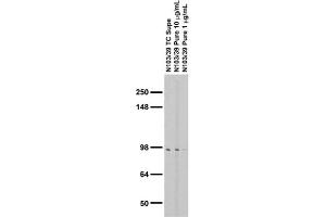 Adult rat brain membrane (RBM) immunoblot. (ALDH1L1 anticorps  (AA 1-902))