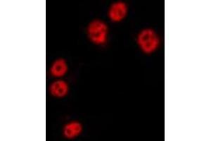 ABIN6275330 staining HepG2 by IF/ICC. (NOL10 anticorps  (C-Term))