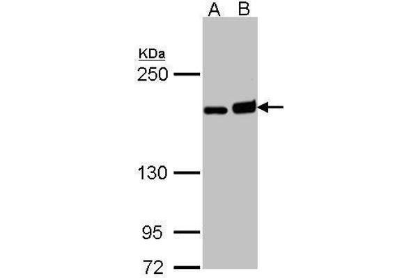 DIAPH1 anticorps  (C-Term)