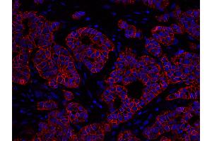 Immunofluorescence (IF) image for anti-Receptor tyrosine-protein kinase erbB-2 (ErbB2/Her2) (C-Term) antibody (ABIN7448962) (ErbB2/Her2 anticorps  (C-Term))