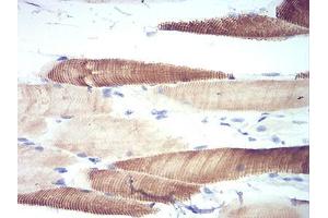 Immunohistochemical analysis of paraffin-embedded striated muscle tissues using ATG13 mouse mAb with DAB staining.