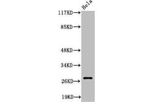 Western Blot analysis of HeLa cells using Cleaved-Integrin α6 LC (E942) Polyclonal Antibody (ITGA6 anticorps  (Cleaved-Glu942))