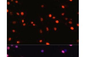 Immunofluorescence analysis of C6 cells using DNMT1 Polyclonal Antibody at dilution of 1:100.