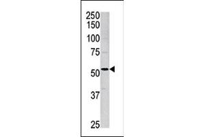 Western blot analysis of anti-ACVR1 Pab (ABIN391156 and ABIN2841266) in mouse brain tissue lysate.