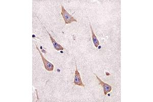 Paraformaldehyde-fixed, paraffin embedded human brain tissue, Antigen retrieval by boiling in sodium citrate buffer (pH6.