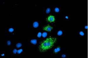 Image no. 9 for anti-Carboxypeptidase A2 (Pancreatic) (CPA2) antibody (ABIN1497596)