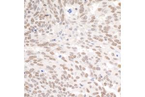 Immunohistochemistry (IHC) image for anti-Polybromo 1 (PBRM1) (AA 1639-1689) antibody (ABIN7453903)