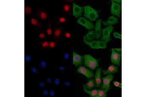 ABIN6257508 and ABIN6273536 staining HepG2 cells by IF/ICC.