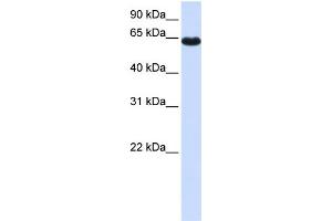 WB Suggested Anti-ZNF117 Antibody Titration:  0. (Zinc Finger Protein 117 anticorps  (Middle Region))