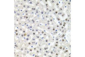 Immunohistochemistry of paraffin-embedded rat liver using U2SURP antibody (ABIN6132839, ABIN6149759, ABIN6149760 and ABIN6220240) at dilution of 1:100 (40x lens). (SR140 anticorps  (AA 705-1029))