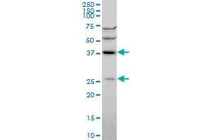 DNAJB6 monoclonal antibody (M01), clone 2C11-C1.