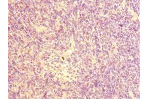 Immunohistochemistry of paraffin-embedded human thymus tissue using ABIN7161343 at dilution of 1:100 (CHRNA1 anticorps  (AA 25-240))