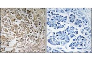 Immunohistochemistry analysis of paraffin-embedded human pancreas, using PEX11C Antibody. (PEX11G anticorps  (AA 11-60))