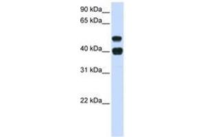 Image no. 1 for anti-Ubiquitin Specific Peptidase 22 (USP22) (AA 72-121) antibody (ABIN6741442) (USP22 anticorps  (AA 72-121))