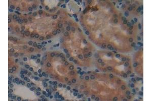 Detection of CTSA in Human Kidney Tissue using Polyclonal Antibody to Cathepsin A (CTSA)