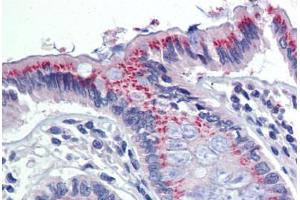 Colon, Human: Formalin-Fixed, Paraffin-Embedded (FFPE) (PDIA3 anticorps)