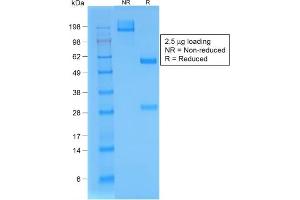 SDS-PAGE Analysis Purified BrdU Rabbit Recombinant Monoclonal Antibody (BRD/1539R). (Recombinant BrdU anticorps)