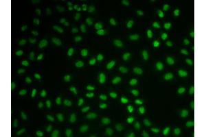 Immunofluorescence (IF) image for anti-Cardiac Troponin C (TNNC1) (AA 1-160) antibody (ABIN6219070) (TNNC1 anticorps  (AA 1-160))