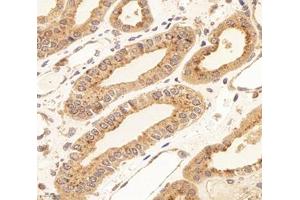 Immunohistochemistry analysis of paraffin-embedded human kidney using,RISC (ABIN7075546) at dilution of 1: 4000 (SCPEP1 anticorps)