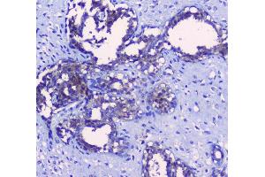 IHC analysis of SRI using anti-SRI antibody (ABIN6719388).