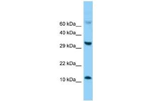 Western Blotting (WB) image for anti-Fatty Acid Binding Protein 5 (Psoriasis-Associated) (FABP5) (C-Term) antibody (ABIN2788321) (FABP5 anticorps  (C-Term))