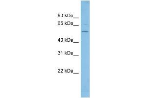 WB Suggested Anti-FGR Antibody Titration: 0. (Fgr anticorps  (Middle Region))