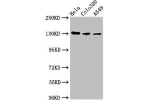 Western Blot Positive WB detected in: Hela whole cell lysate, Colo320 whole cell lysate, A549 whole cell lysate All lanes: ITGAV antibody at 2. (CD51 anticorps  (AA 775-885))
