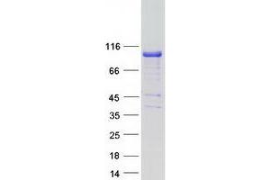 Validation with Western Blot