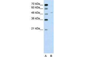 Western Blotting (WB) image for anti-Zinc Finger Protein 19 (ZNF19) antibody (ABIN2462568) (ZNF19 anticorps)