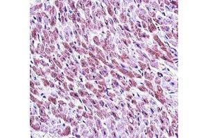 SMAD3 antibody immunohistochemistry analysis in formalin fixed and paraffin embedded human heart tissue. (SMAD3 anticorps  (AA 127-156))