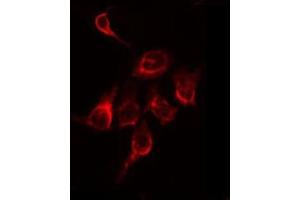 ABIN6266590 staining A549 by IF/ICC.