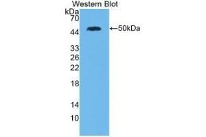 Detection of Recombinant IL28A, Human using Monoclonal Antibody to Interleukin 28A (IL28A) (IL28A anticorps  (AA 26-200))