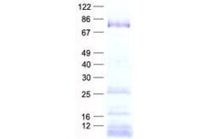 Validation with Western Blot