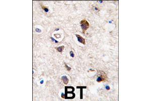 Formalin-fixed and paraffin-embedded human brain tissue reacted with PRKCG polyclonal antibody  , which was peroxidase-conjugated to the secondary antibody, followed by DAB staining . (PKC gamma anticorps  (C-Term))