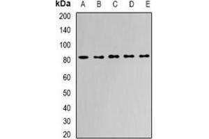 Western blot analysis of APEH expression in Jurkat (A), HepG2 (B), mouse liver (C), mouse kidney (D), rat bone marrow (E) whole cell lysates.