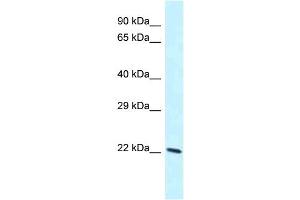 WB Suggested Anti-Laptm4b Antibody Titration: 1. (LAPTM4B anticorps  (C-Term))