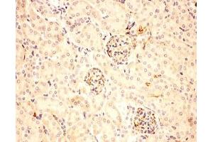IHC-P: ACTH antibody testing of mouse kidney tissue (ACTH anticorps  (Middle Region))
