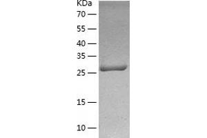 Western Blotting (WB) image for Zinc Finger Protein 33A (ZNF33A) (AA 453-738) protein (His tag) (ABIN7125787) (ZNF33A Protein (AA 453-738) (His tag))