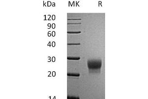 Colony Stimulating Factor 3 (Granulocyte) (CSF3) protein (His tag)