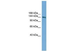 WB Suggested Anti-DCC Antibody Titration:  0. (DCC anticorps  (Middle Region))