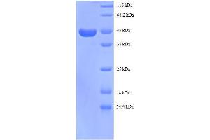Ribosomal Protein S13 (RPS13) (AA 3-151), (partial) protein (GST tag)