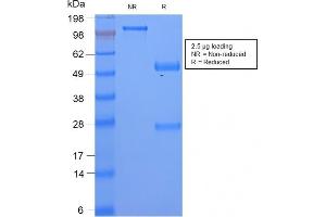 anti-Serum Amyloid A (SAA) antibody
