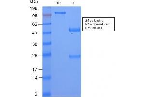 SDS-PAGE Analysis Serum Amyloid A Rabbit Recombinant Monoclonal Antibody (SAA/2868R). (Recombinant SAA anticorps)