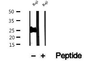 Western blot analysis of extracts of Raji cells, using PCMT1 antibody. (PCMT1 anticorps  (Internal Region))