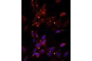 Immunofluorescence analysis of NIH/3T3 cells using IKBKE antibody.