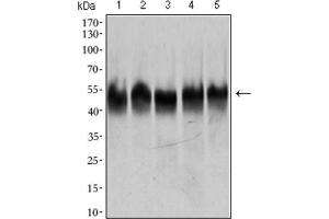Western Blotting (WB) image for anti-Tubulin, beta 2A (TUBB2A) (AA 25-187) antibody (ABIN1846607) (TUBB2A anticorps  (AA 25-187))