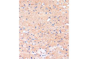 Immunohistochemistry of paraffin-embedded Mouse heart using ME3 Rabbit pAb (ABIN7268384) at dilution of 1:100 (40x lens). (ME3 anticorps  (AA 505-604))