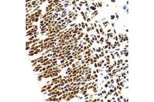 Immunohistochemistry of paraffin-embedded Human embryo brain using Histone H3 antibody at dilution of 1:100 (x400 lens). (Histone 3 anticorps  (C-Term))