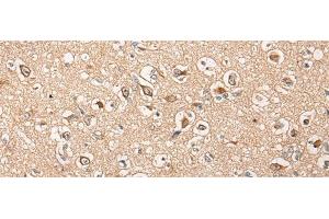 Immunohistochemistry of paraffin-embedded Human brain tissue using HTRA1 Polyclonal Antibody at dilution of 1:55(x200)