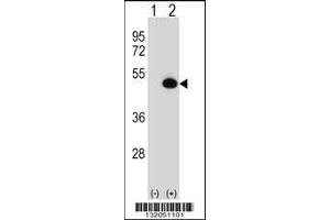 Western blot analysis of ASS1 using rabbit polyclonal ASS1 Antibody using 293 cell lysates (2 ug/lane) either nontransfected (Lane 1) or transiently transfected (Lane 2) with the ASS1 gene. (ASS1 anticorps  (C-Term))